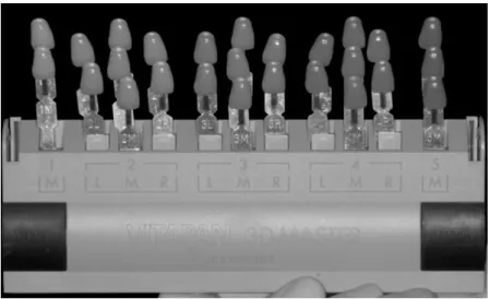 Figure  10  :  Teintier  VITA  Toothguide  3D  MASTER®  en  niveaux  de  gris  avec  échantillons  rangés  par  ordre de luminosité décroissante de la gauche vers la droite 