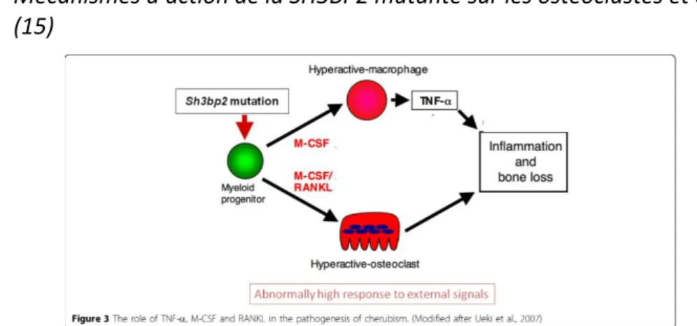 Figure 6 : Rôle du TNFalpha, M-CSF et RANKL dans la pathogénicité du chérubisme (15)  D’après  les  travaux  de  Reichenberger  en  2012,  la  SH3BP2  mutante possèderait  un  rôle  régulateur sur le facteur de transcription clef de l’ostéoclastogénèse NFA