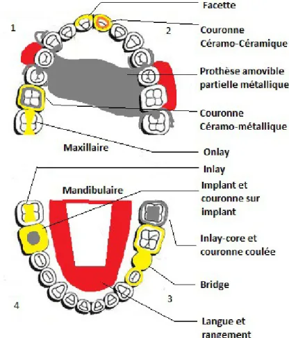 Figure 8. Schéma de répartition des soins présents sur le modèle de démonstration