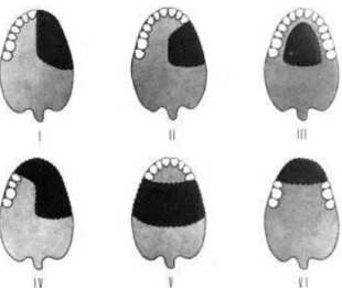 Figure 9: Classification d’Aramany d’après Aramany MA (38) 