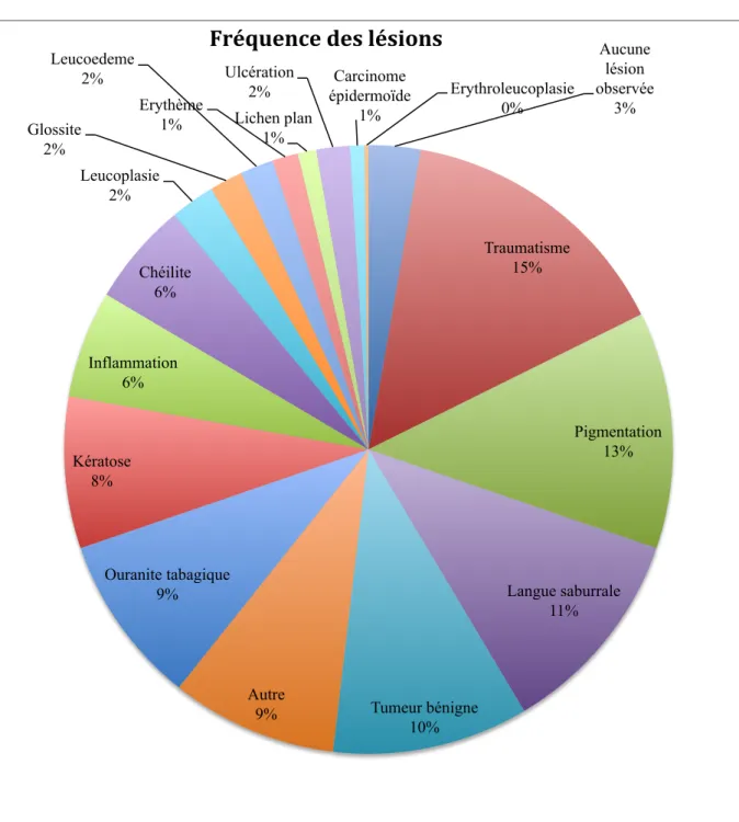 Diagramme 1 : Fréquence des lésions observées  Aucune  lésion  observée  3%  Traumatisme  15%  Pigmentation  13%  Langue saburrale  11%  Tumeur bénigne  10% Autre 9% Ouranite tabagique 9% Kératose 8% Inflammation 6% Chéilite 6% Leucoplasie 2% Glossite 2% L