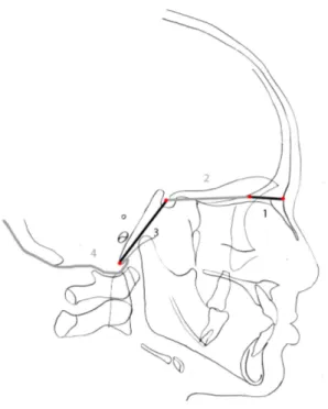 Figure  1 :  les  territoires  basicrâniens  de  Delaire.  1.  Segment  fronto-nasal  2