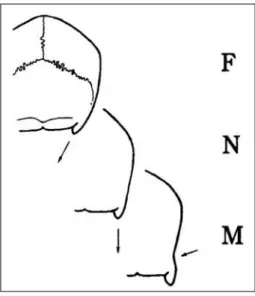 Figure 12 : classification de l’orientation du processus mastoïde (23) 