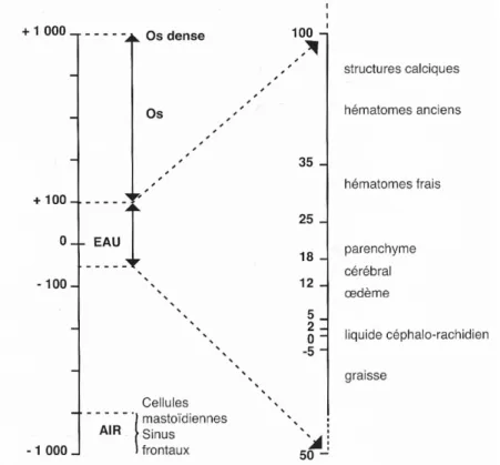 Figure 12 : Echelle de densités de Hounsfield. (46) 