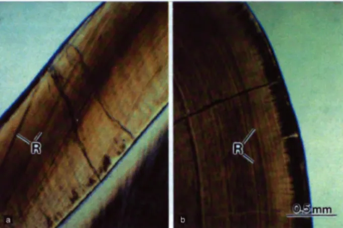 Figure 4 : Microphotographie en microscopie optique d’émail humain.  