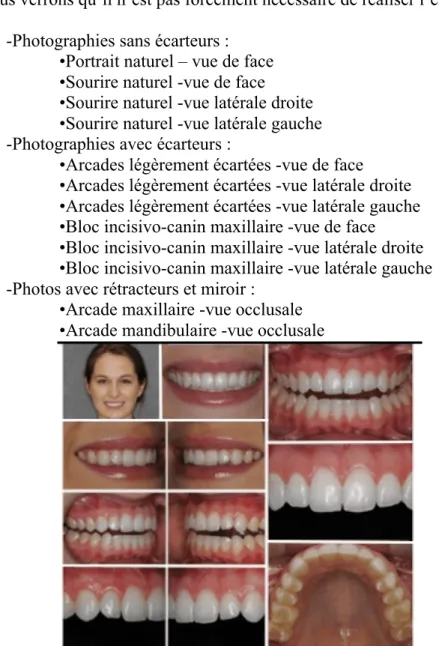 Figure 28 : Protocole photographique complet selon AACD (American Academy of Cosmetic Dentistry)