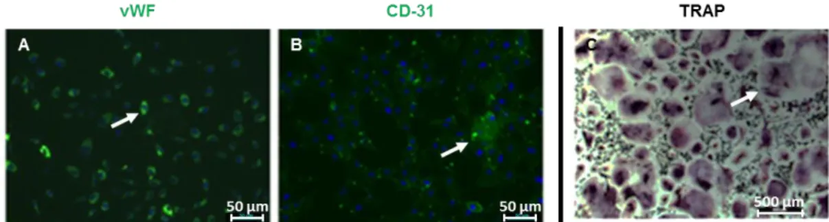 Figure 13 : Les caractéristiques des cellules progénitrices endothéliales et des cellules ostéoclastiques  sont mises en évidence en présence d’EGM2*/αMEM