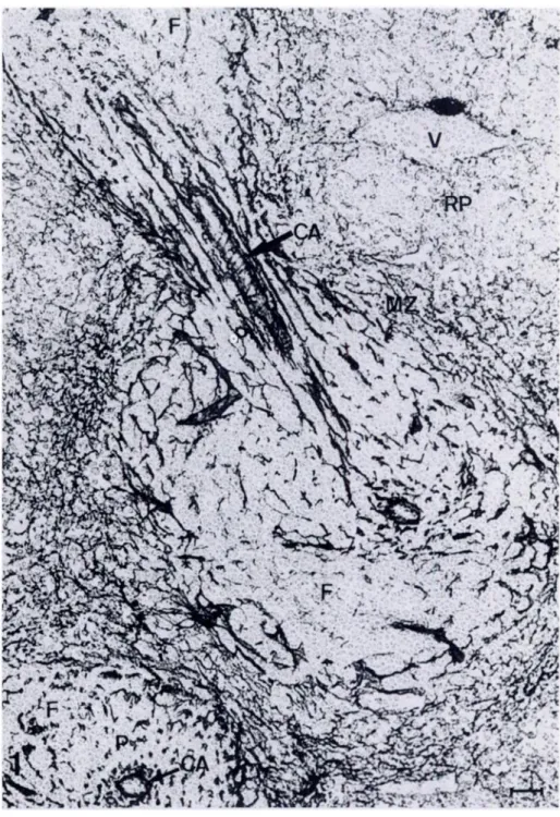 Figure 1. Immunoperoxidase staining pat- pat-tern of frozen section of spleen. Section  in-cubated with monoclonal antibody ER-TR7, followed by RaRa-lg-HRP and DAB
