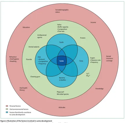 Figure 2 : Illustration des facteurs intervenant dans le développement de la carie (10) 