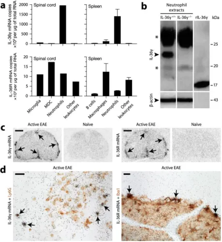 Figure  2-2.  IL-36γ  is  selectively  expressed  by  neutrophils,  while  IL-36R  is  expressed by different leukocytes such as monocytic cells