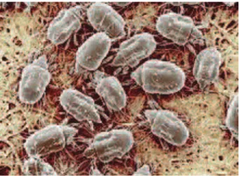Figure 2 : Photo actuelle de la mite du fromage observée au microscope 