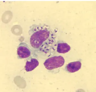 Figure 4 : Amastigote de leishmanies dans des macrophages coloration au May Grünwald Giemsa tiré de Public Health Image Labrary (PHIL) du CDC (Center for Disease Control and Prevention)