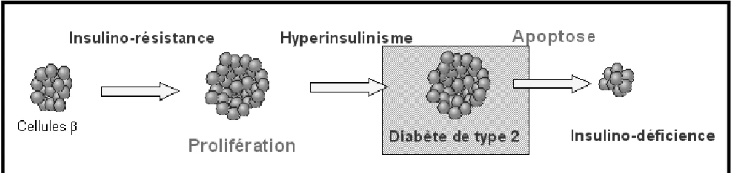 Figure 11 : Insulinorésistance et insulinodéficience. 