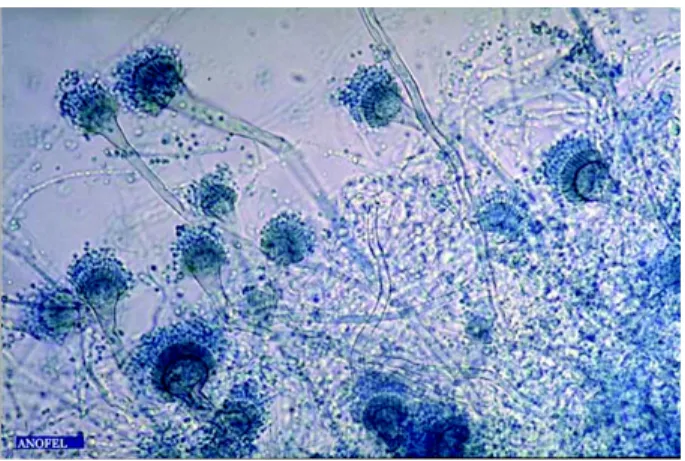 Figure 2.1 – A. fumigatus d’après Parasitoses et mycoses des régions tempérées et tro- tro-picales