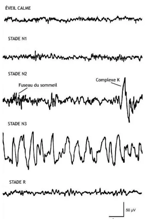 Figure 1 : Enregistrement EEG chez l’Homme durant les différents stades de  sommeil  