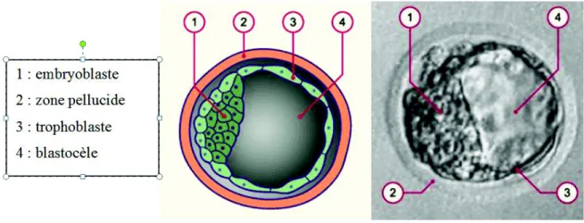 Figure 9 : schéma et photographie d'un blastocyste au cinquième jour, d'après Dr. A. Senn et al,  CHUV Lausanne