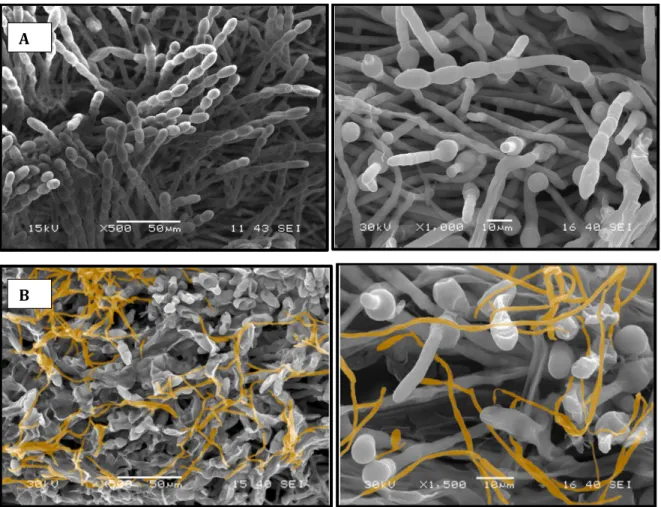 Figure  4:  Scanning  electron  microscopy  observations  of  barley  powdery  mildew  fungus (A) before and (B) after treatment with Pseudozyma flocculosa