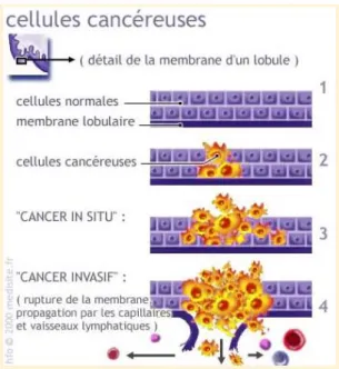 Figure 2 : Mécanisme de développement des cellules cancéreuses. Source : www.e-cancer.fr 