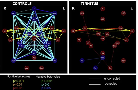 Fig. 1 – Connectivity graphs for the 15 healthy controls and the 13 tinnitus patients' groups