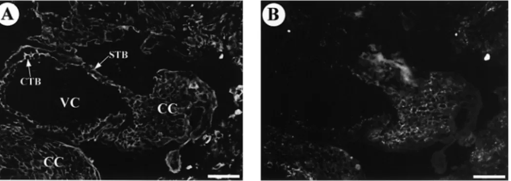 Figure 5. First trimester anchoring villi section double-immunolabelled for cytokeratin 07 (A) and Cx40 protein (B)