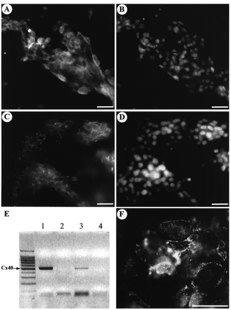 Figure 6. (A, B) Double immunofluorescence for α 5 β 1 integrin (A) and for nuclear staining with DAPI (B) in first trimester cytotrophoblastic cells cultured on Matrigel for 48 h