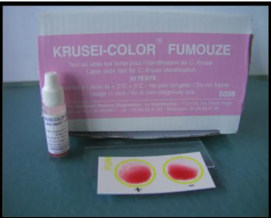 Fig 10 : Kit Krusei color avec exemple d’une réaction positive. 