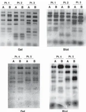 Figure 13: Typage par PCR-RFLP MSG (d'après Rostved et al., Transplantation, 2013).