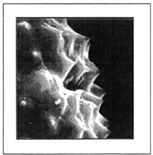Figure 11  : Pollen d'Amhrosia artemisiifolia  L. 
