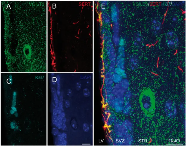 Figure 6: Section transversale prise au niveau du striatum et de la zone sous-ventriculaire (SVZ),  marquée pour VGluT3 (A, vert), SERT (B, rouge), Ki67 (C, bleu  pâle) et DAPI (D, bleu foncé)