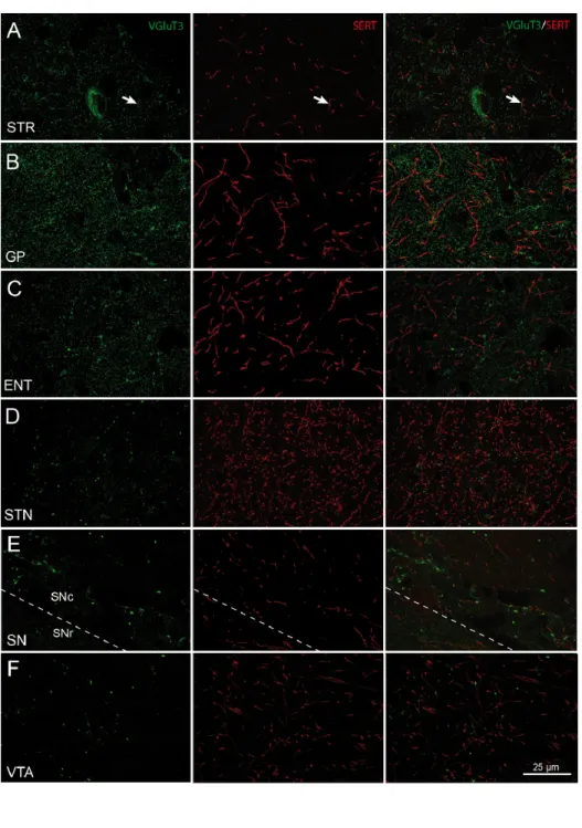 Figure 7: Images prises au microscope confocal montrant l’immunomarquage pour SERT et VGluT3  dans les axones présents dans les principales composantes des ganglions de la base