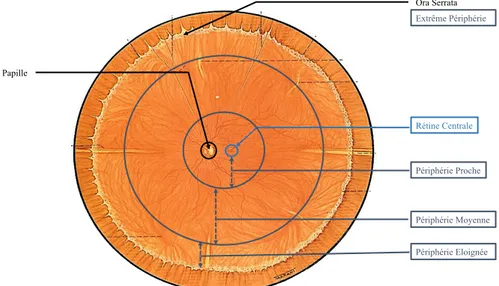 Figure 14 : Dessin de rétine grand angle  (14)