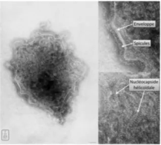 Figure 1 : photographie par microscopie électronique à transmission   en coloration négative [18] 