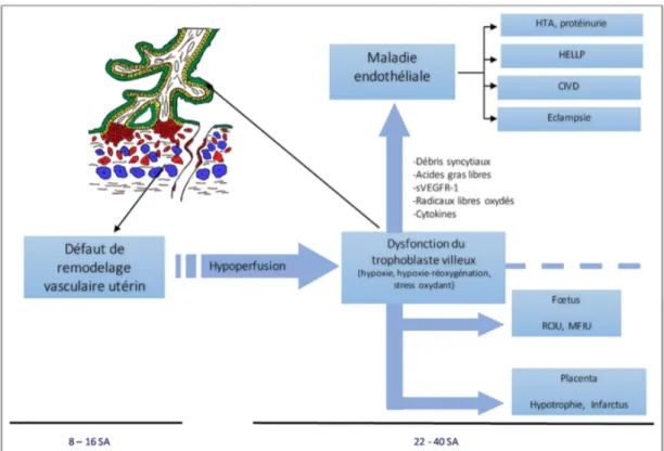 Figure 10 : Schéma physiopathologique de la prééclampsie (47). 