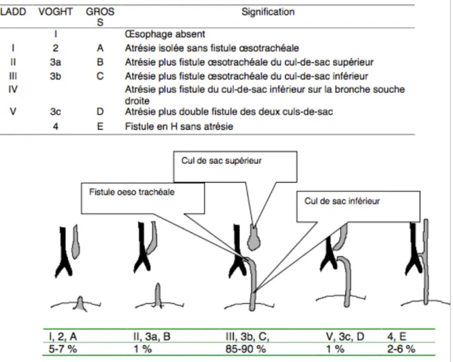 Figure 4: Classifications anatomiques des AO(3) 