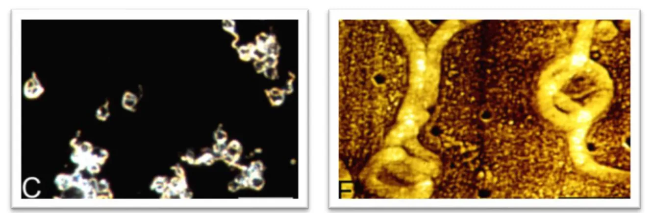 Figure 13. Étapes de formation des corps ronds en microscopie électronique en transmission (87)  Échelle : (a) 0,8 ; 0,5 ; 0,8 et 0,6 cm    500 nm 