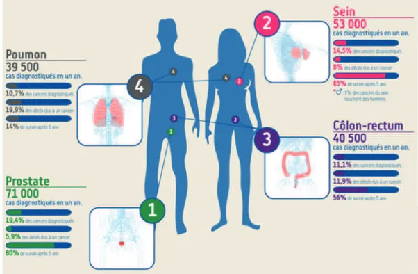 Figure 23 – 4 principaux cancers en 2013 selon La Ligue contre le Cancer