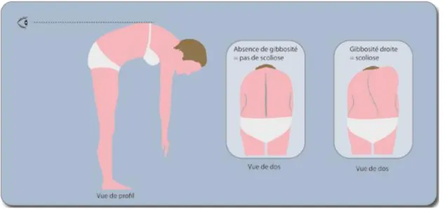 Figure 4 : Examen dans le plan horizontal  (19) 