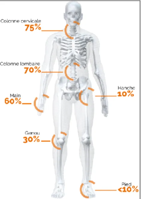 Figure 5 Fréquence et localisation de l'arthrose en fonction des articulations (24) 