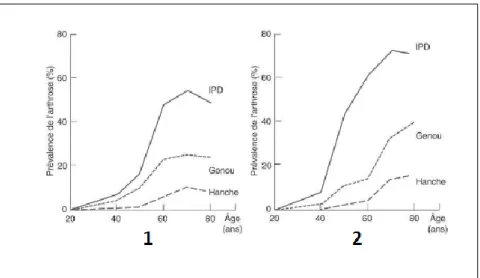 Figure 6 Prévalence de l'arthrose de la localisation, de l'âge et du sexe (1 : chez l'homme 