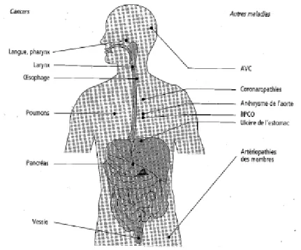 Figure I.6. Les principales maladies liées au tabac