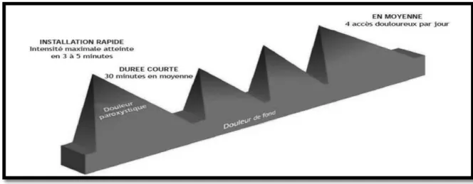 Figure 1- Les ADP 