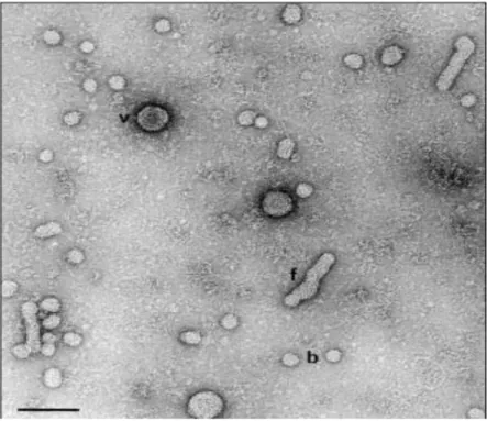 Figure 1 :  Particules virales de l’hépatite B observées au microscope électronique (Roingeart P  et Hourioux C 1999)