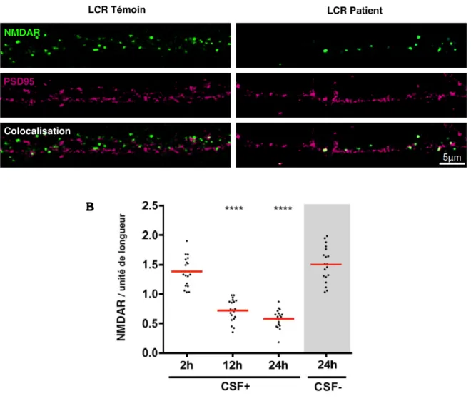 Figure  3  |  Diminution  de  la  densité  en  NMDAR  à  la  surface  des  post- post-synapses neuronales
