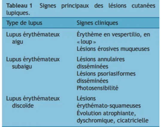 TABLEAU 8 : SIGNES PRINCIPAUX DES LÉSIONS CUTANÉES LUPIQUES (7)