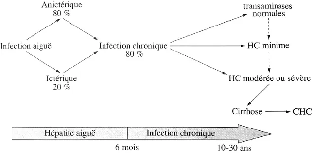 Figure 7. Evolution d’une infection par le VHC (9)   (HC : Hépatite chronique ; CHC : Carcinome hépatocellulaire) 