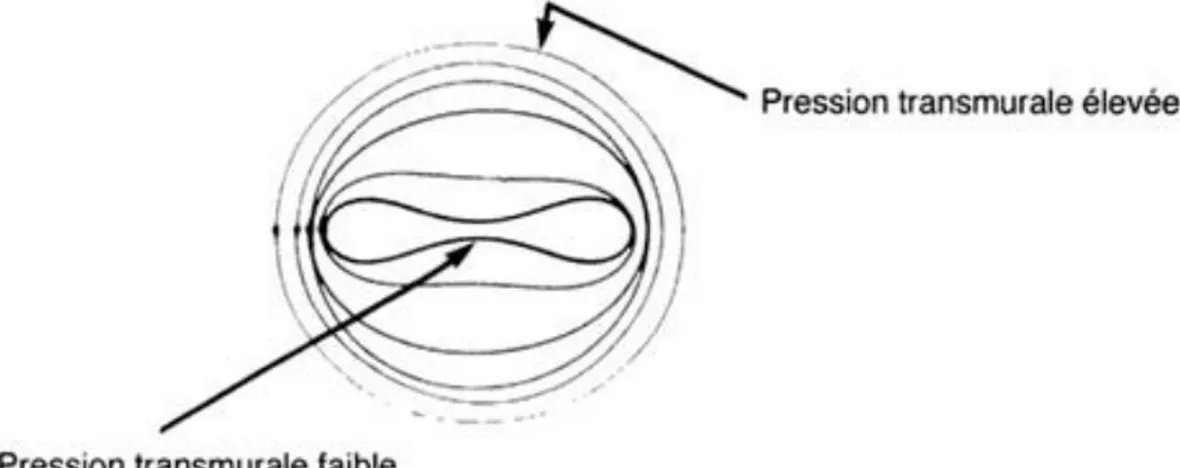 Figure 8 : Variation de l'aspect de la veine en fonction de la pression transmurale 