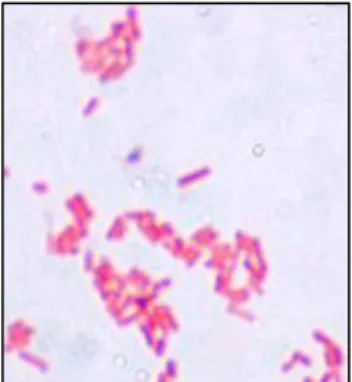 Figure 12  Observation au microscope d’E.coli coloré au Gram (Article Soza TH baban, Prevalence and antimicrobial  susceptibility, Août 2017)  