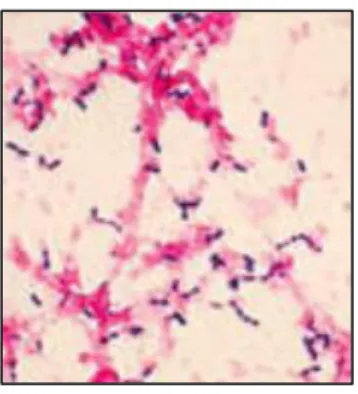 Figure 13 Observation au microscope de S. pneumoniae coloré au Gram (Text book of bacteriology, page 1,  Streptococcus pneumoniae, 2019) 