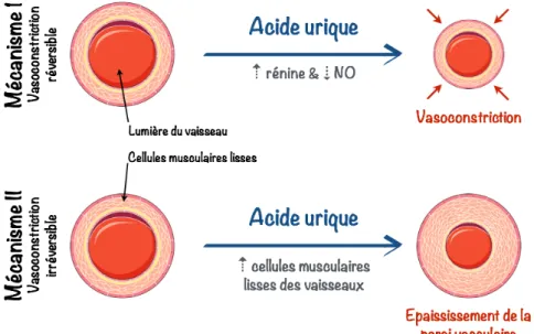 Figure 14 : Modèle de dysfonctions endothéliales induites par  l’acide urique à l’origine d’une hypertension artérielle
