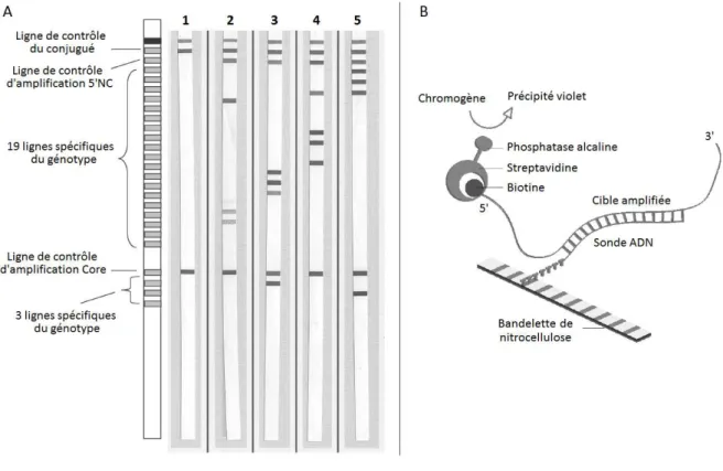 Figure 5. Génotypage par la technique LiPA 
